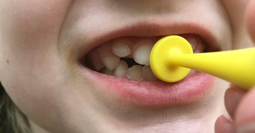 Comment stimuler la fermeture des lèvres avec l'exercice du bouton ? Comment stimuler la fermeture des lèvres avec l'exercice du bouton ?