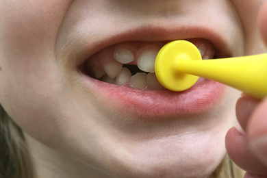 Comment stimuler la fermeture des lèvres avec l'exercice du bouton ?